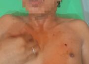 Polisi Buru Pelaku Penikaman di Plampang, Korban Ditikam Tanpa Sebab yang Jelas