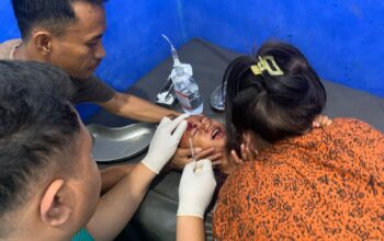 ANAK 3 TAHUN DISERANG DAN DIGIGIT ANJING DIDUGA RABIES DI MANGGELEWA, POLISI IMBAU WARGA WASPADA