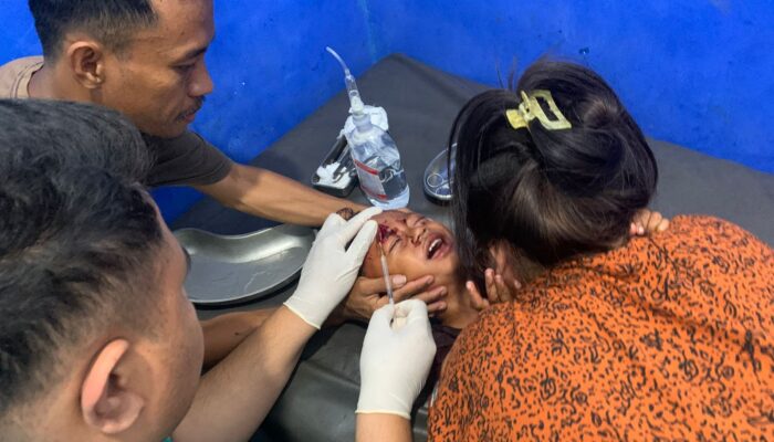 ANAK 3 TAHUN DISERANG DAN DIGIGIT ANJING DIDUGA RABIES DI MANGGELEWA, POLISI IMBAU WARGA WASPADA